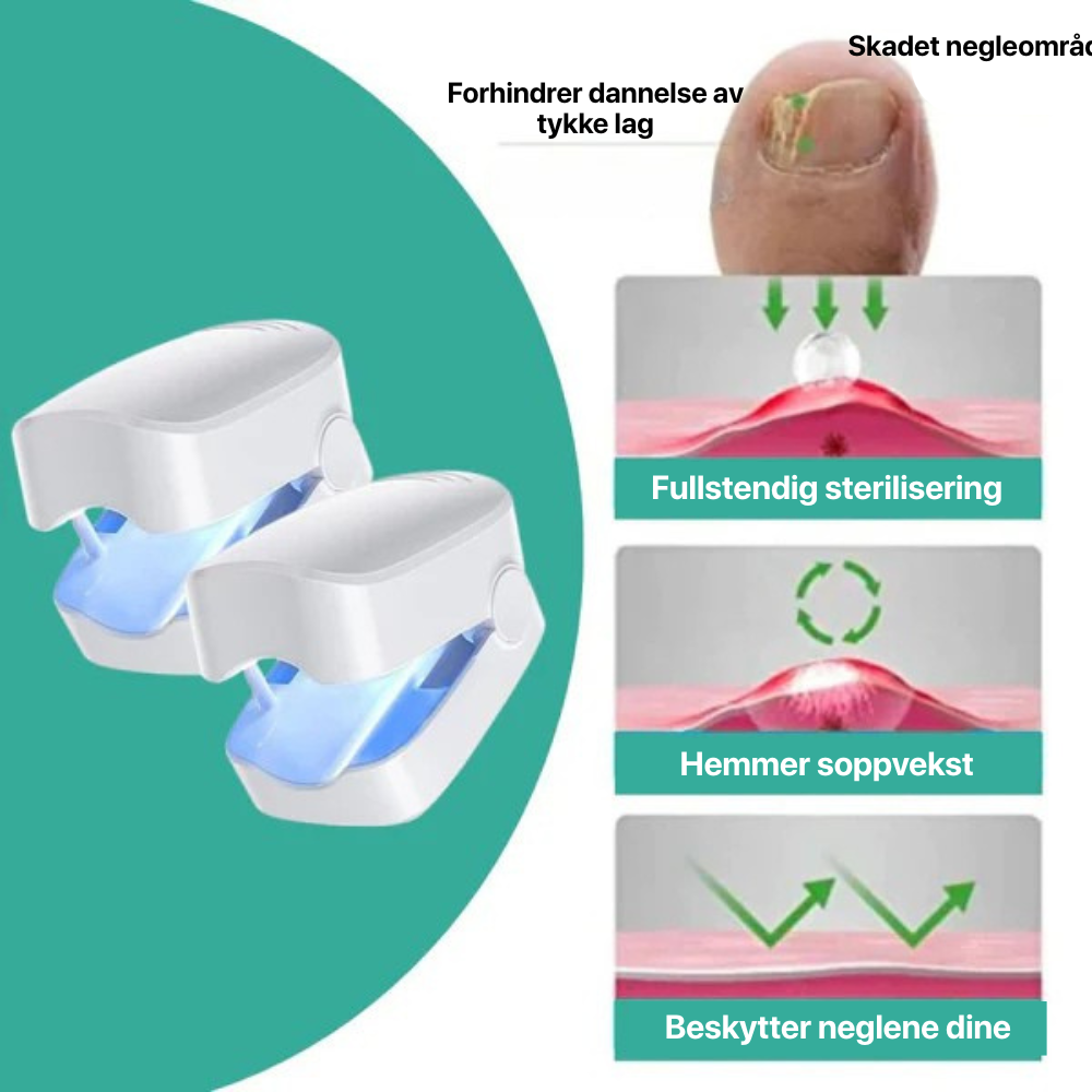 Sanovia® - NAILCURE PRO | APPARAT MOT NAGELSVAMP